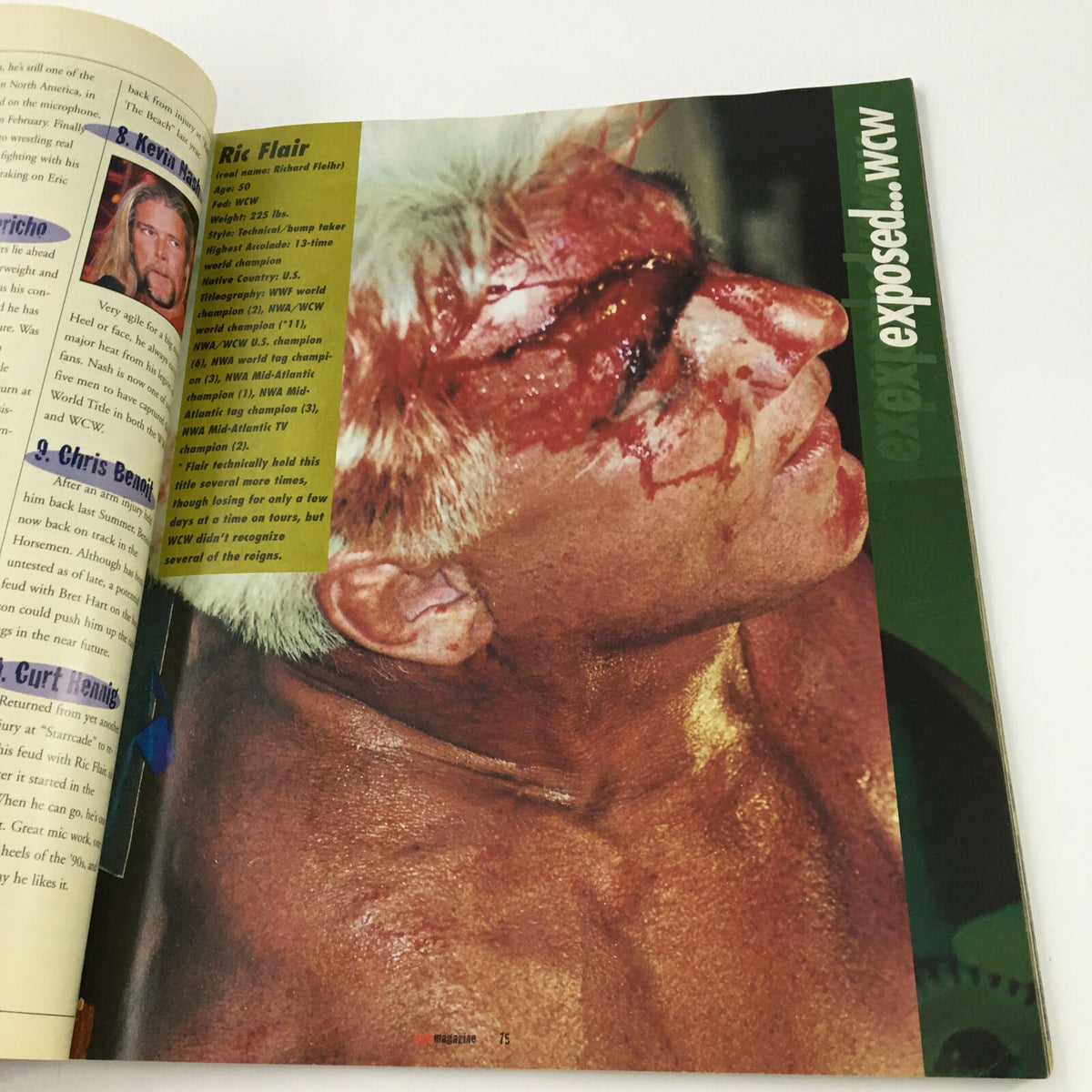 WWF World of Wrestling Magazine May 1999 close-up image of wrestler Ric Flair with visible injuries, depicting the intense nature of professional wrestling.