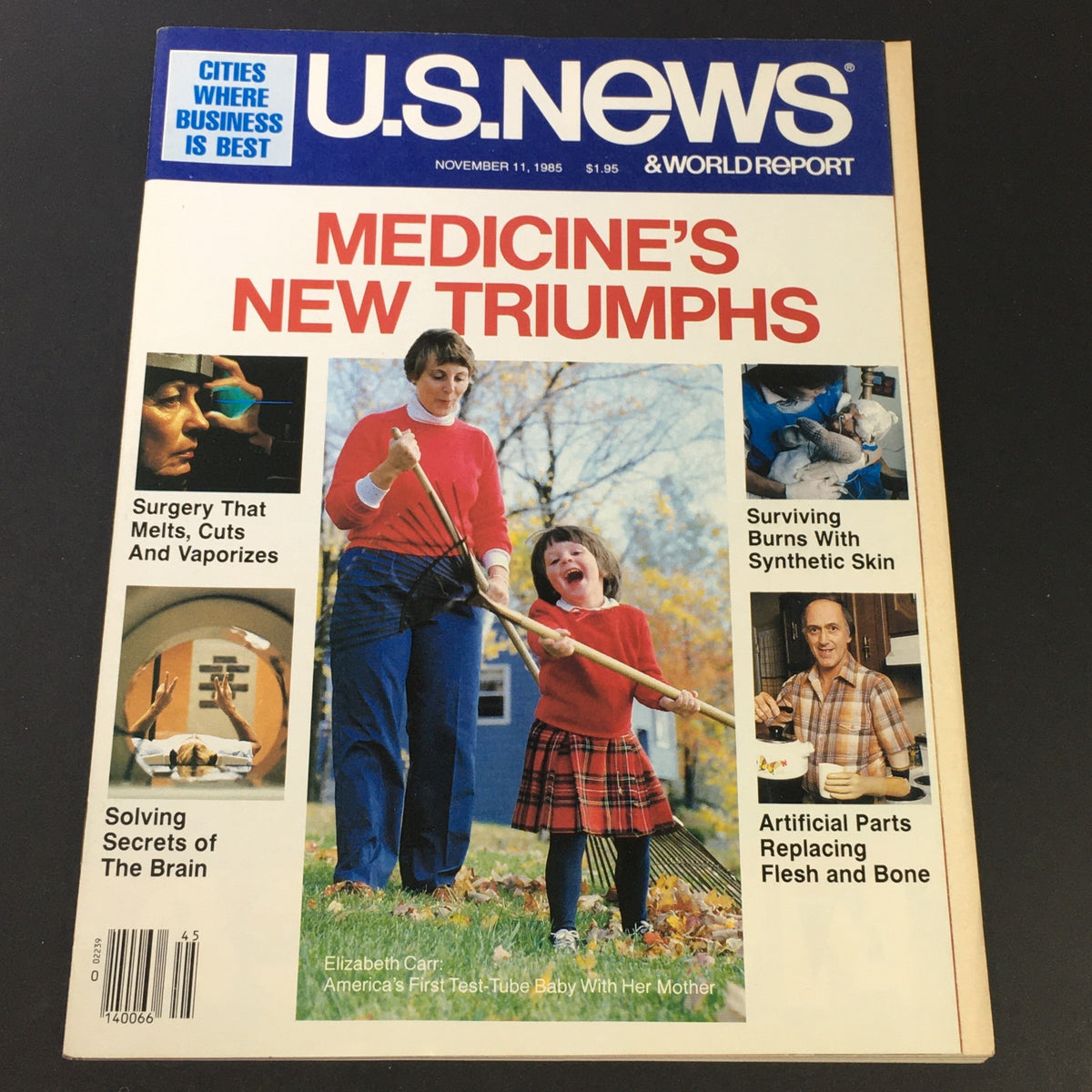 Cover of VTG US News & World Report November 11 1985 - Medicine's New Triumph featuring articles on surgery, skin treatment, and artificial body parts, with images of a child playing and medical themes.