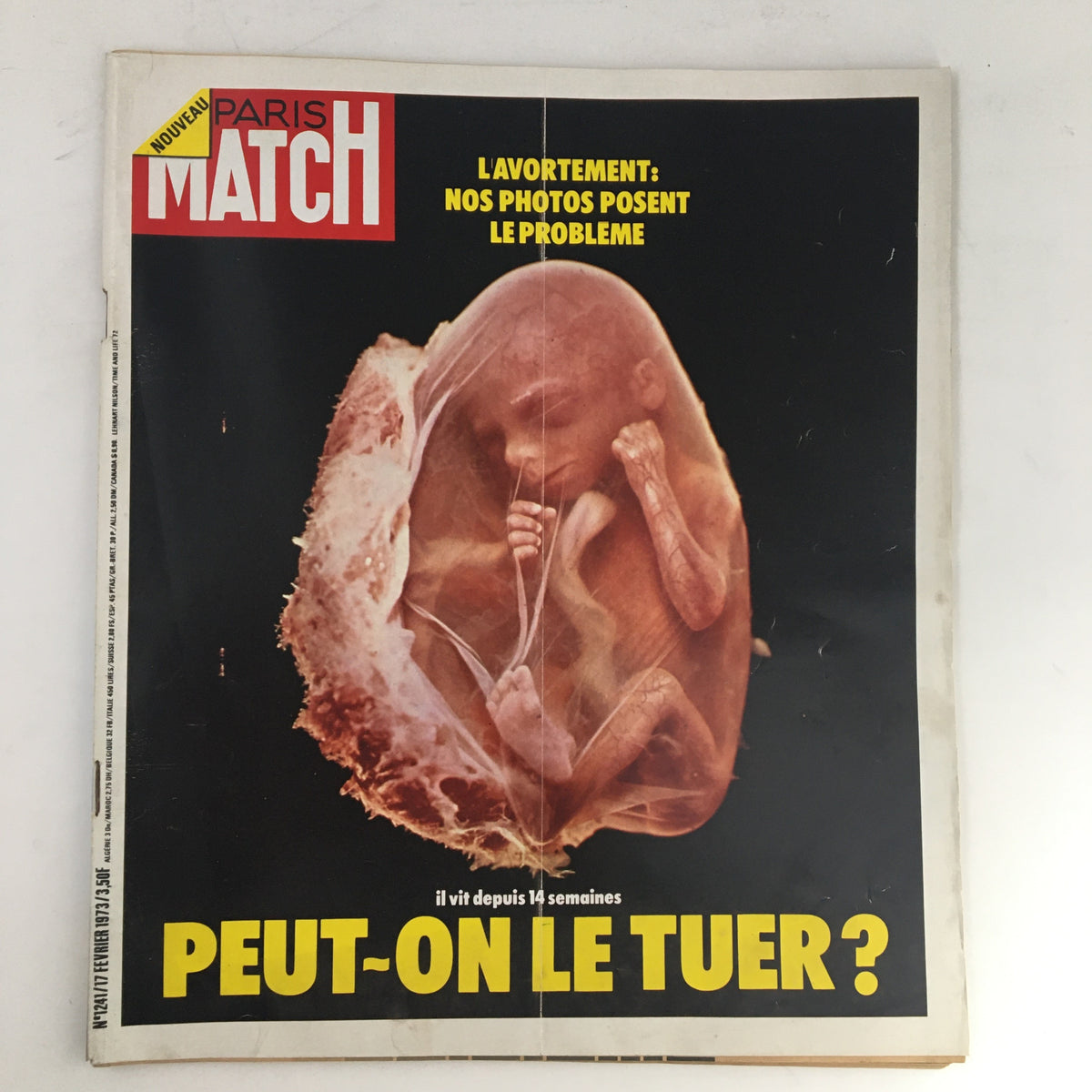 Cover of Paris Match Magazine February 1973 titled 'L'avortement: Nos Photos Posent Le Problema'. Features a striking image of a fetus in utero, posing a moral question about abortion.