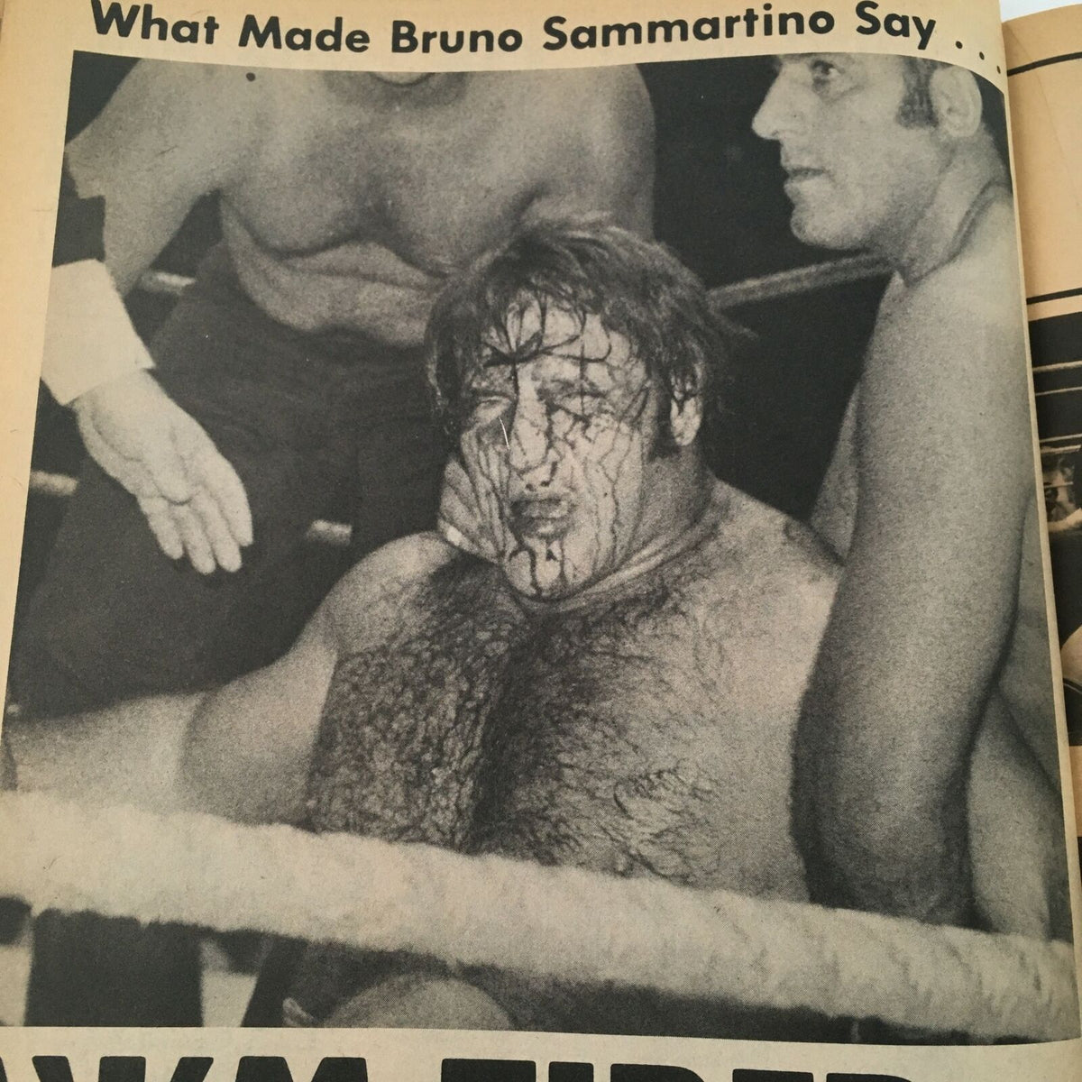 Black and white image from Pro Wrestling Illustrated Magazine July 1980 depicting a bruised wrestle with an article about Bruno Sammartino, reflecting the intense atmosphere of wrestling matches.