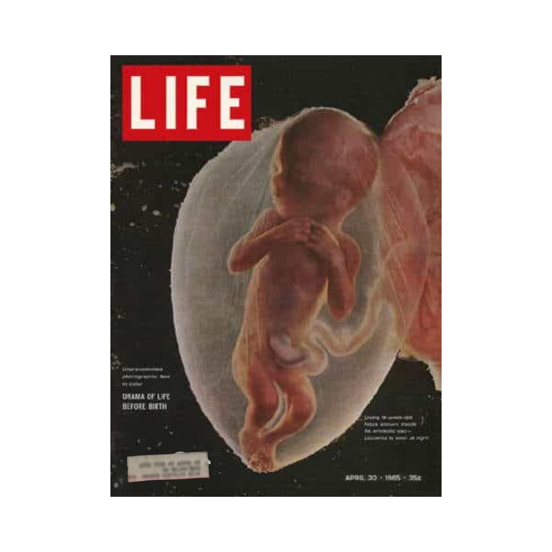 VTG Life Magazine April 30, 1965 cover featuring a dramatic image of an embryo within the womb, highlighting the theme 'Life Before Birth'.
