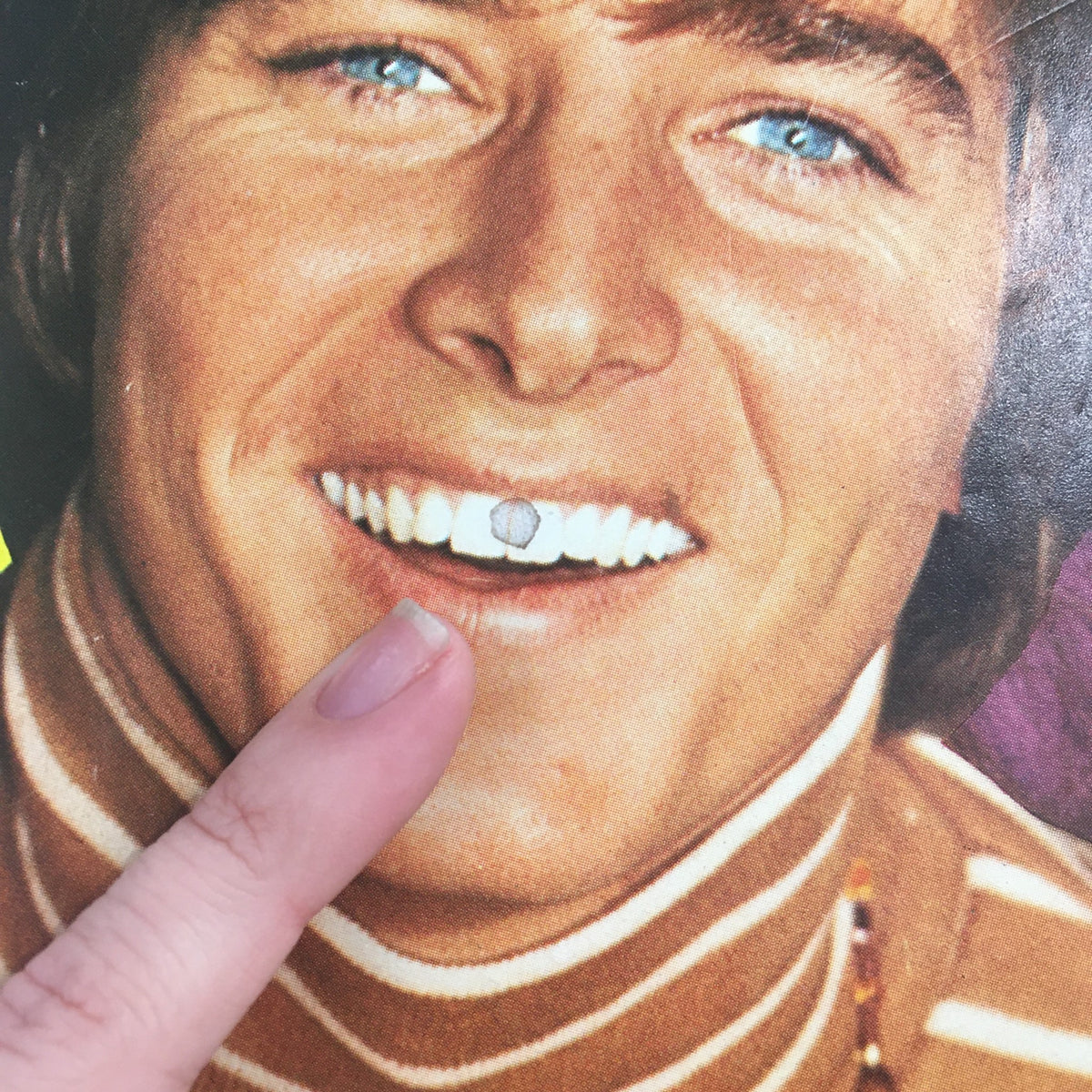 Close-up of a smiling man's face with striking blue eyes, pointing at a detail on his teeth, from Tiger Beat Magazine August 1969.