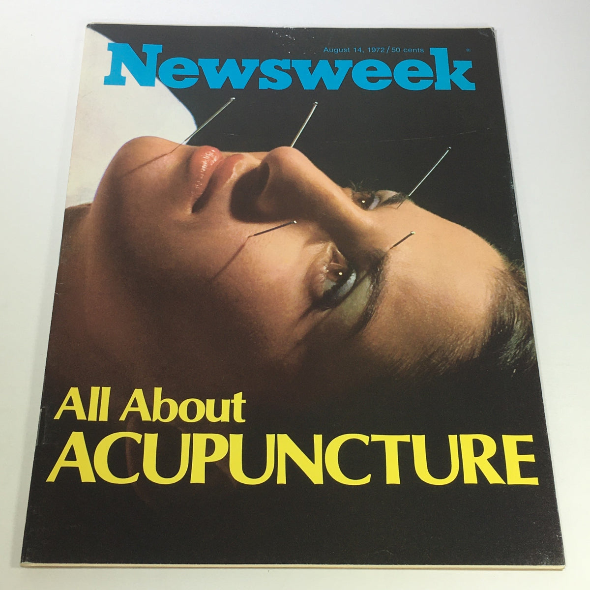 VTG Newsweek Magazine Cover from August 14, 1972 featuring the title 'All About Acupuncture' with an image of a woman receiving acupuncture, highlighting the practice of alternative medicine.