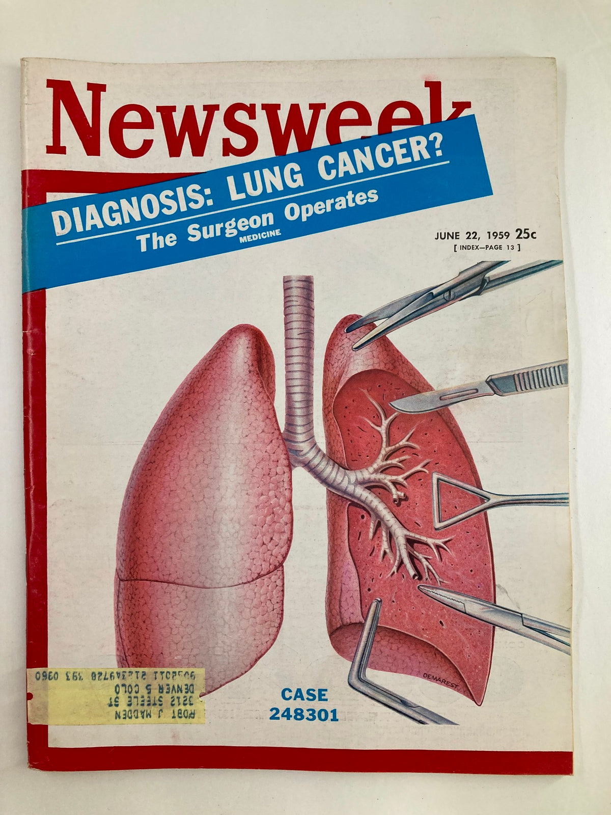 VTG Newsweek Magazine June 22 1959 cover featuring the title 'Diagnosis: Lung Cancer? The Surgeon Operates', showcasing a detailed illustration of lungs and surgical tools, reflecting medical advances of the late 1950s.