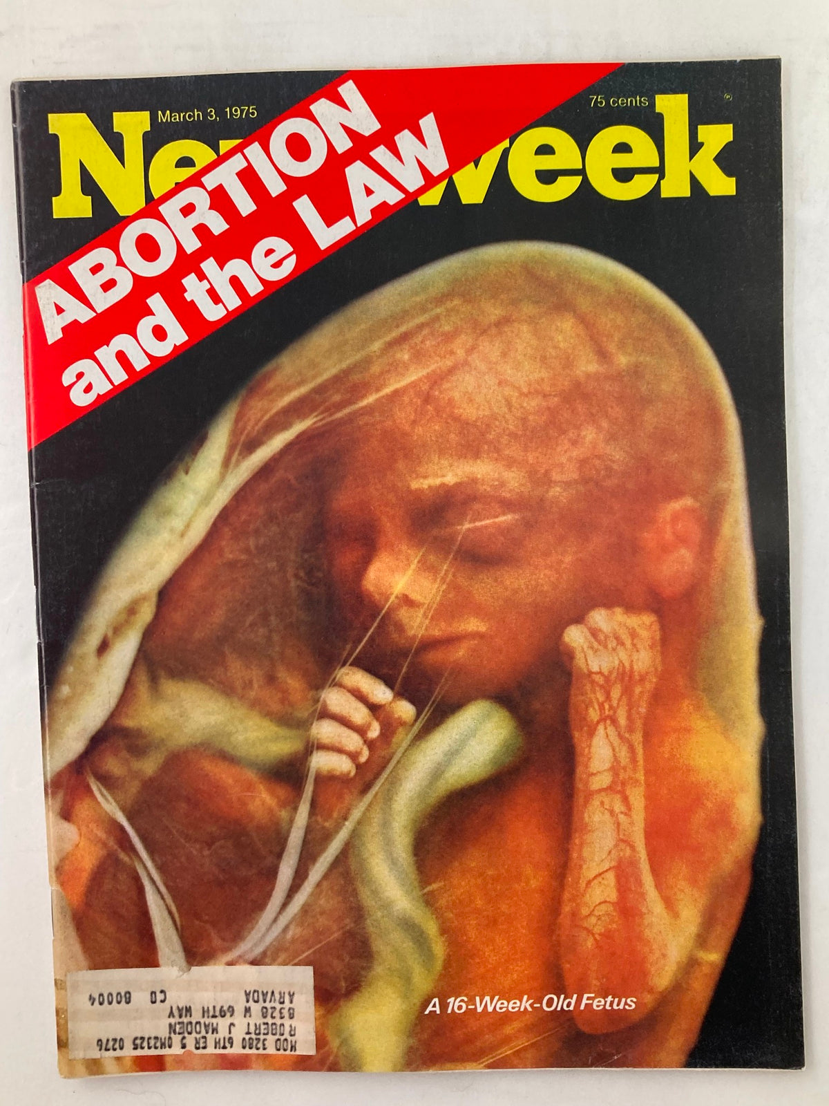 VTG Newsweek Magazine March 3 1975 cover featuring an illustration of a 16-week-old fetus with the title 'Abortion and the Law' prominently displayed in red.