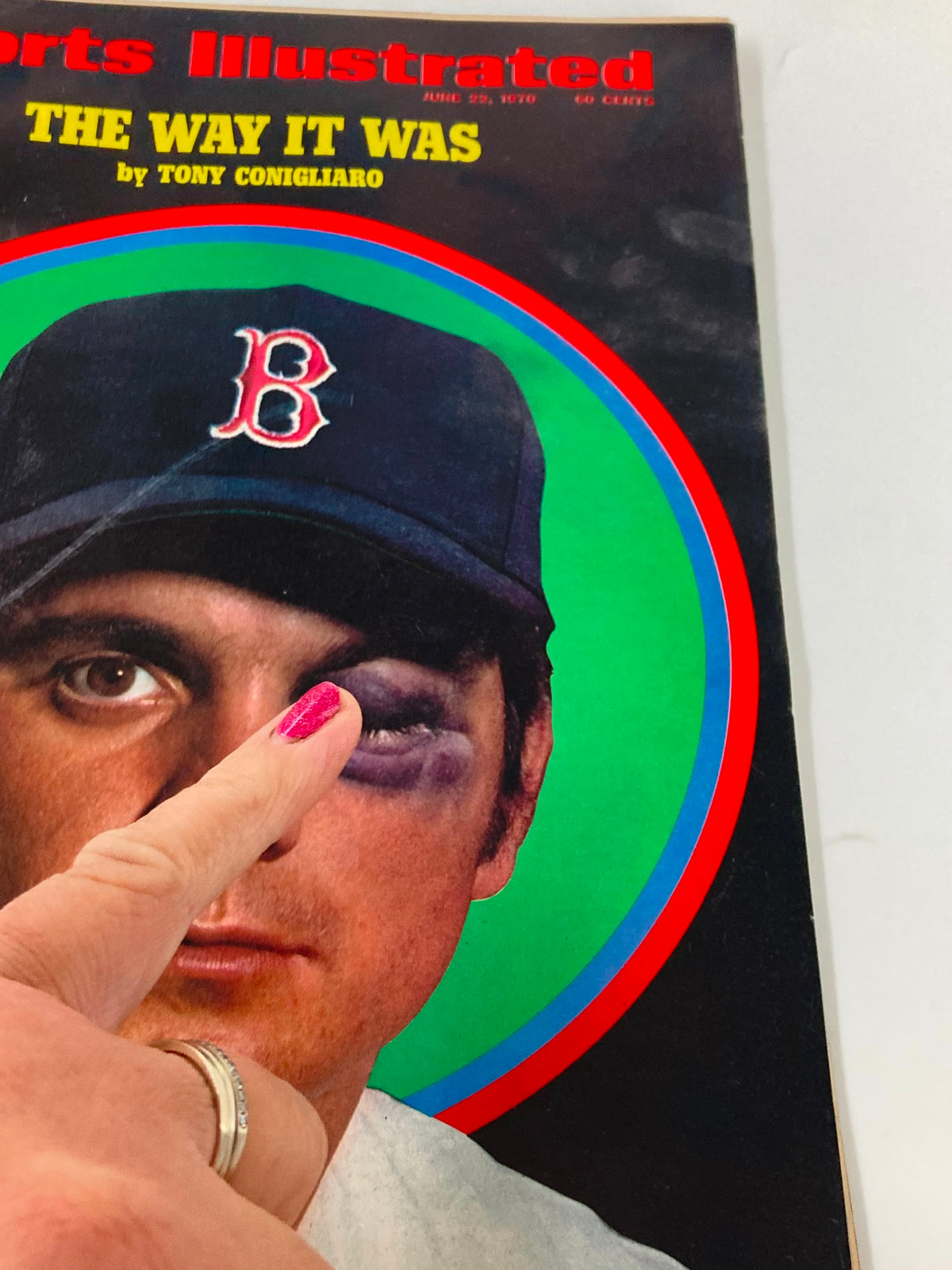 Close-up of the front cover of Sports Illustrated magazine, June 22, 1970, highlighting the article 'The Way It Was' by Tony Conigliaro. A finger points to the black eye on Conigliaro's portrait, emphasizing the condition.