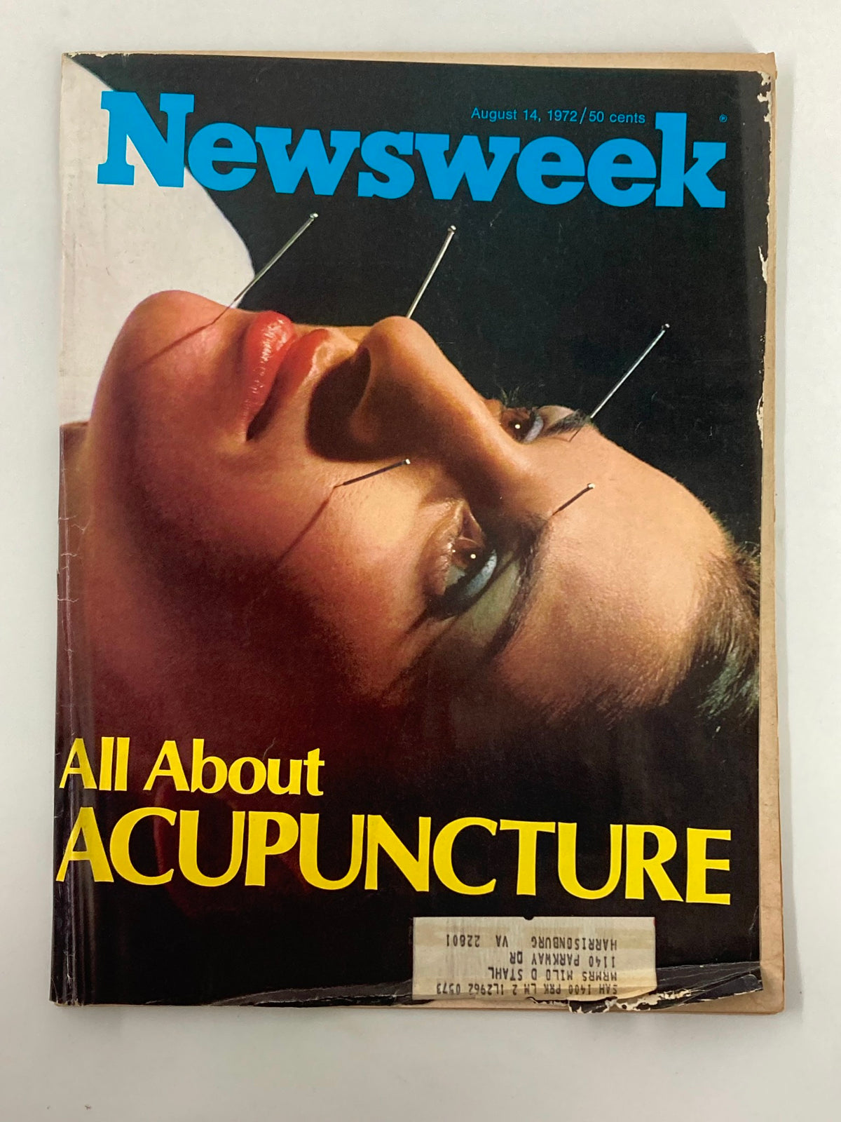 Cover of VTG Newsweek Magazine August 14 1972, featuring a woman receiving acupuncture with needles, showcasing the issue's theme 'All About Acupuncture'.