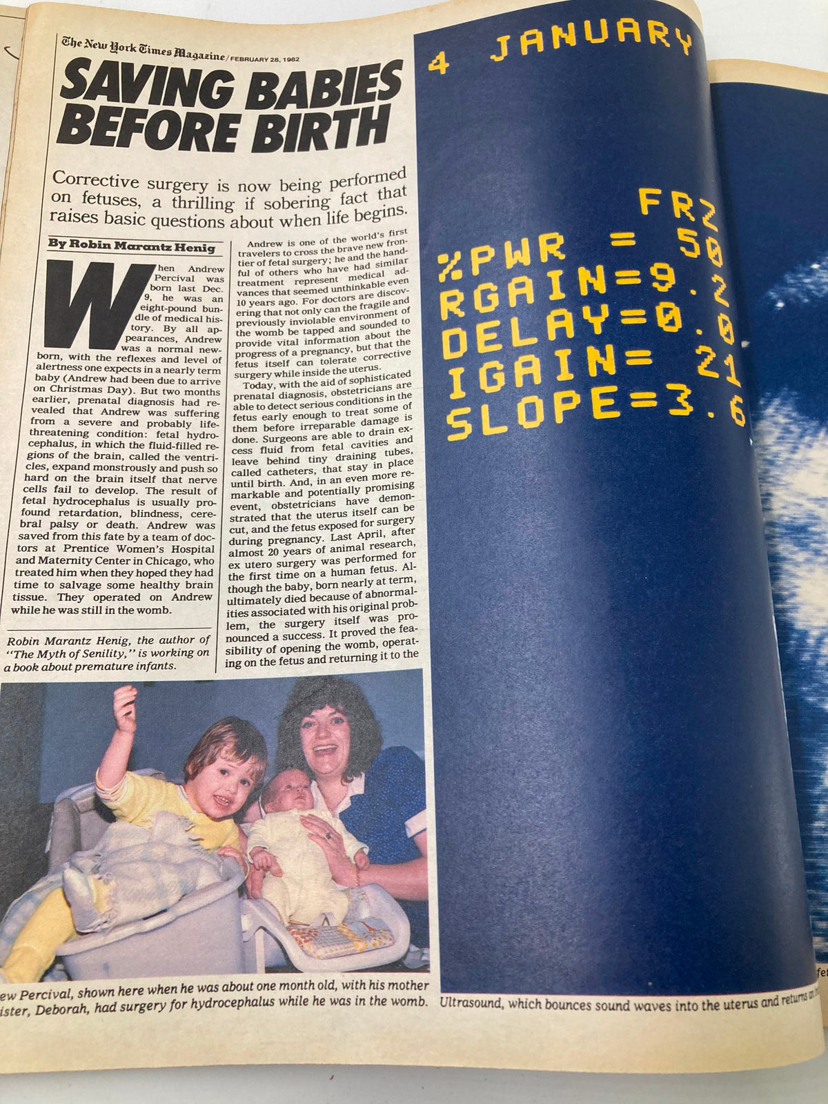 Article page from VTG The New York Times Magazine February 28, 1982, titled 'Saving Babies Before Birth' featuring a photograph of a mother with her two children discussing fetal surgery.
