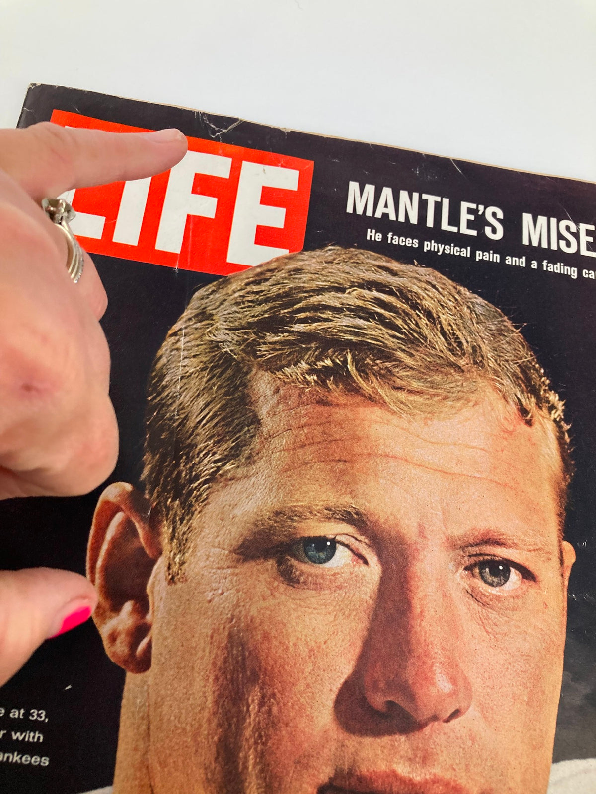 Detailed image of the Life Magazine cover, July 30, 1965, emphasizing the title 'Mantle's Misery' and showcasing Mickey Mantle's face.