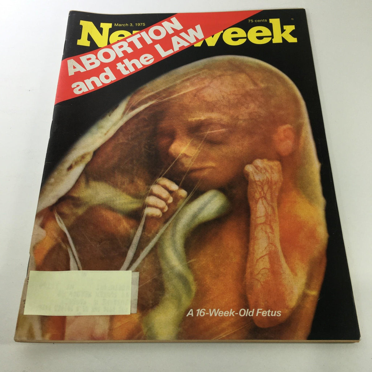 Cover of Newsweek Magazine dated March 3, 1975, featuring a striking visual of a 16-week-old fetus with bold text reading 'Abortion and the Law.' This vintage magazine illustrates the historical significance of reproductive rights discussions during the 1970s.