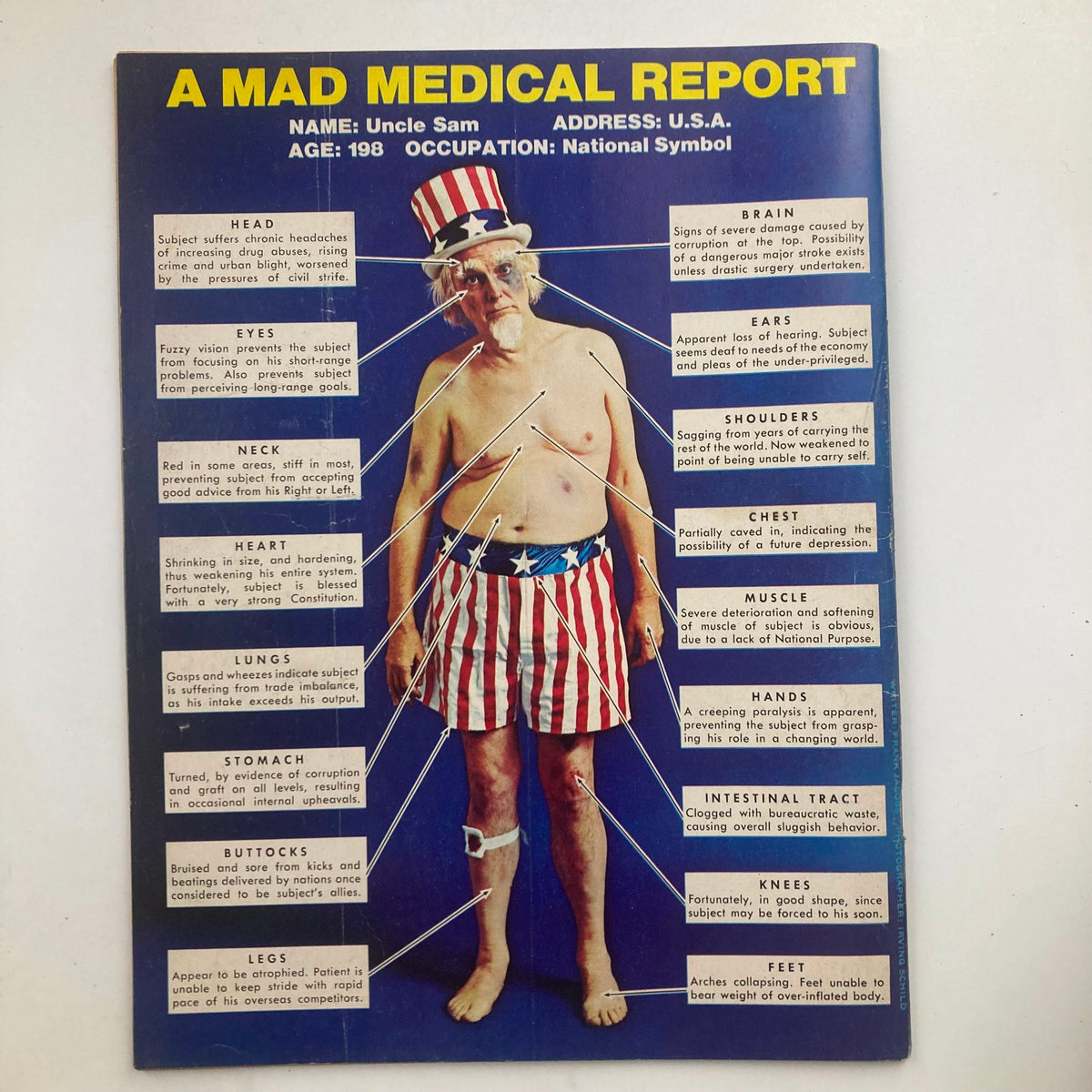 Cover of Mad Magazine July 1974 No. 168 featuring a humorous medical report on Uncle Sam, highlighting various ailments with comedic annotations, showcasing classic satire and cultural commentary.